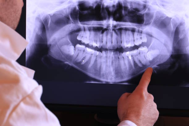 Best Walk-In Emergency Dentist in North York, PA