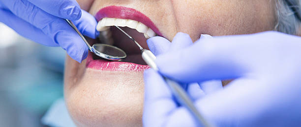 Best Emergency Treatment for Toothache in North York, PA